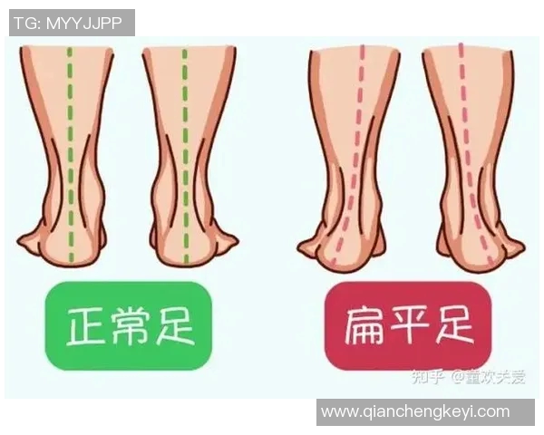 足球明星也有扁平足的烦恼揭秘运动员的足部健康与表现关系